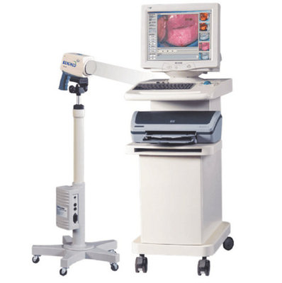 Digital Video Colposcope BeneVC-2000