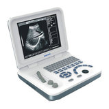 Notebook Ultrasound scanner BW-6