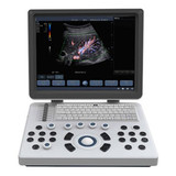 Ultraslim Laptop Color Doppler Ultrasound BENE-3S