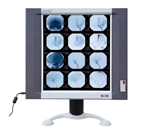 LED X-ray film viewer 